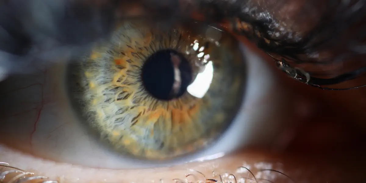 Augenkrankheiten, die mit Augenlasern behandelbar sind: